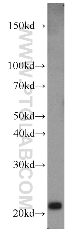 Western Blot (WB) analysis of HEK-293 cells using MAX Polyclonal antibody (10426-1-AP)