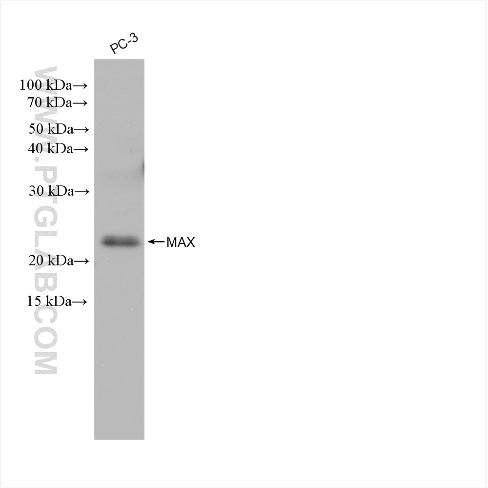 Western Blot (WB) analysis of various lysates using MAX Recombinant antibody (82958-1-RR)