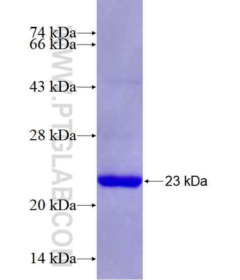 MAX fusion protein Ag28542 SDS-PAGE