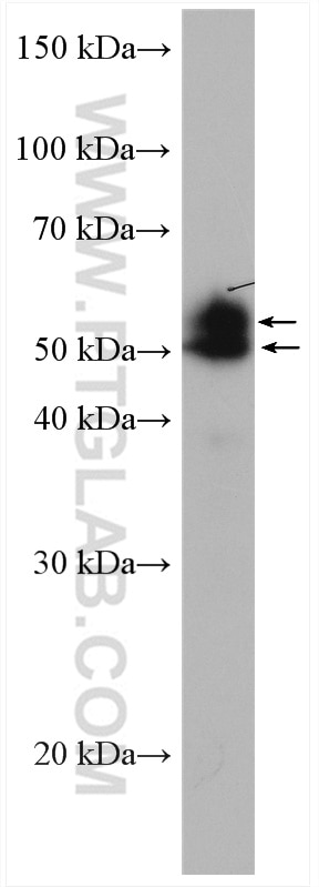 Western Blot (WB) analysis of mouse lung tissue using MAZ Polyclonal antibody (21068-1-AP)