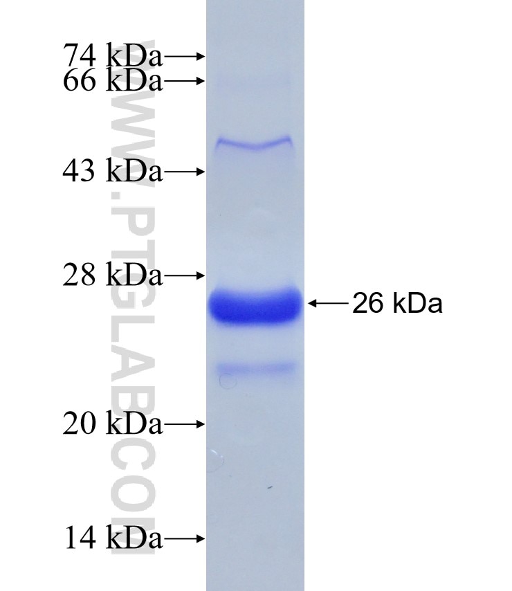 MAZ fusion protein Ag15180 SDS-PAGE