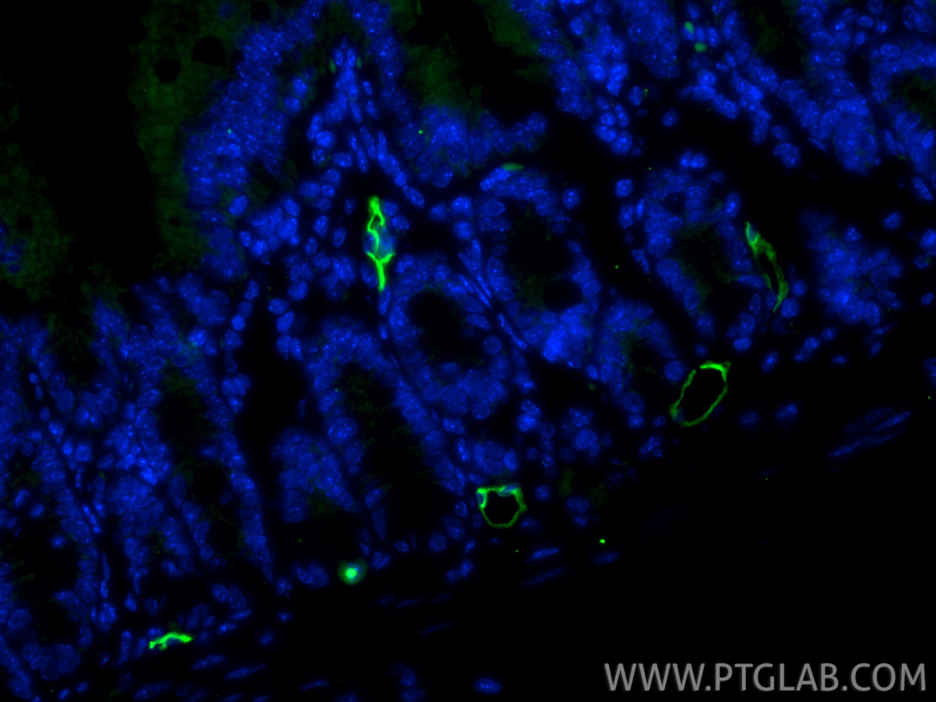 Immunofluorescence (IF) / fluorescent staining of mouse small intestine tissue using MAdCAM1 Polyclonal antibody (32526-1-AP)