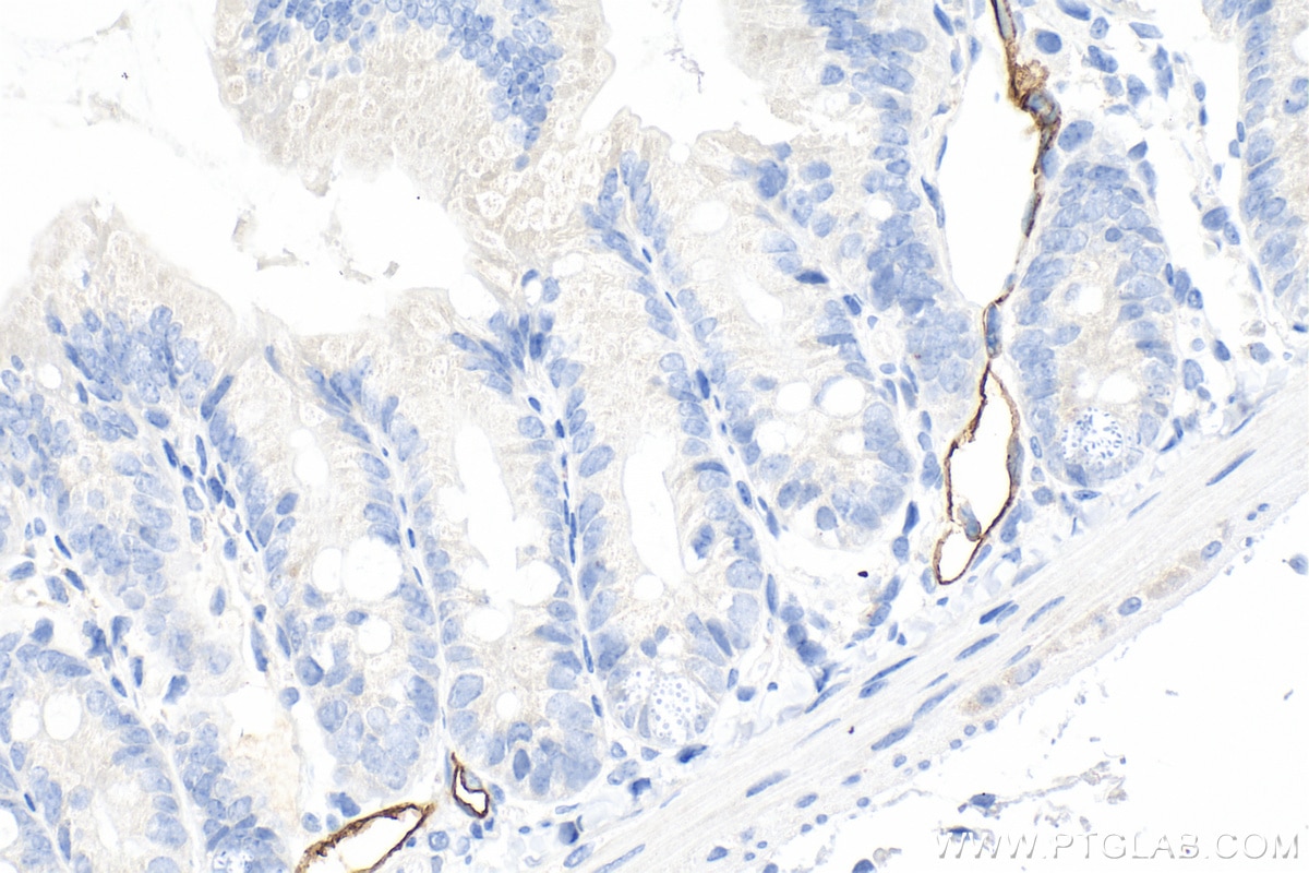 Immunohistochemistry (IHC) staining of mouse small intestine tissue using MAdCAM1 Polyclonal antibody (32526-1-AP)