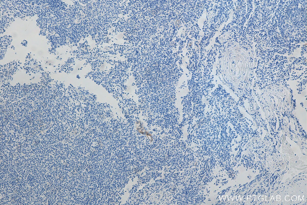 Immunohistochemistry (IHC) staining of human tonsillitis tissue using Biotin-conjugated MAdCAM1 Monoclonal antibody (Biotin-66594)