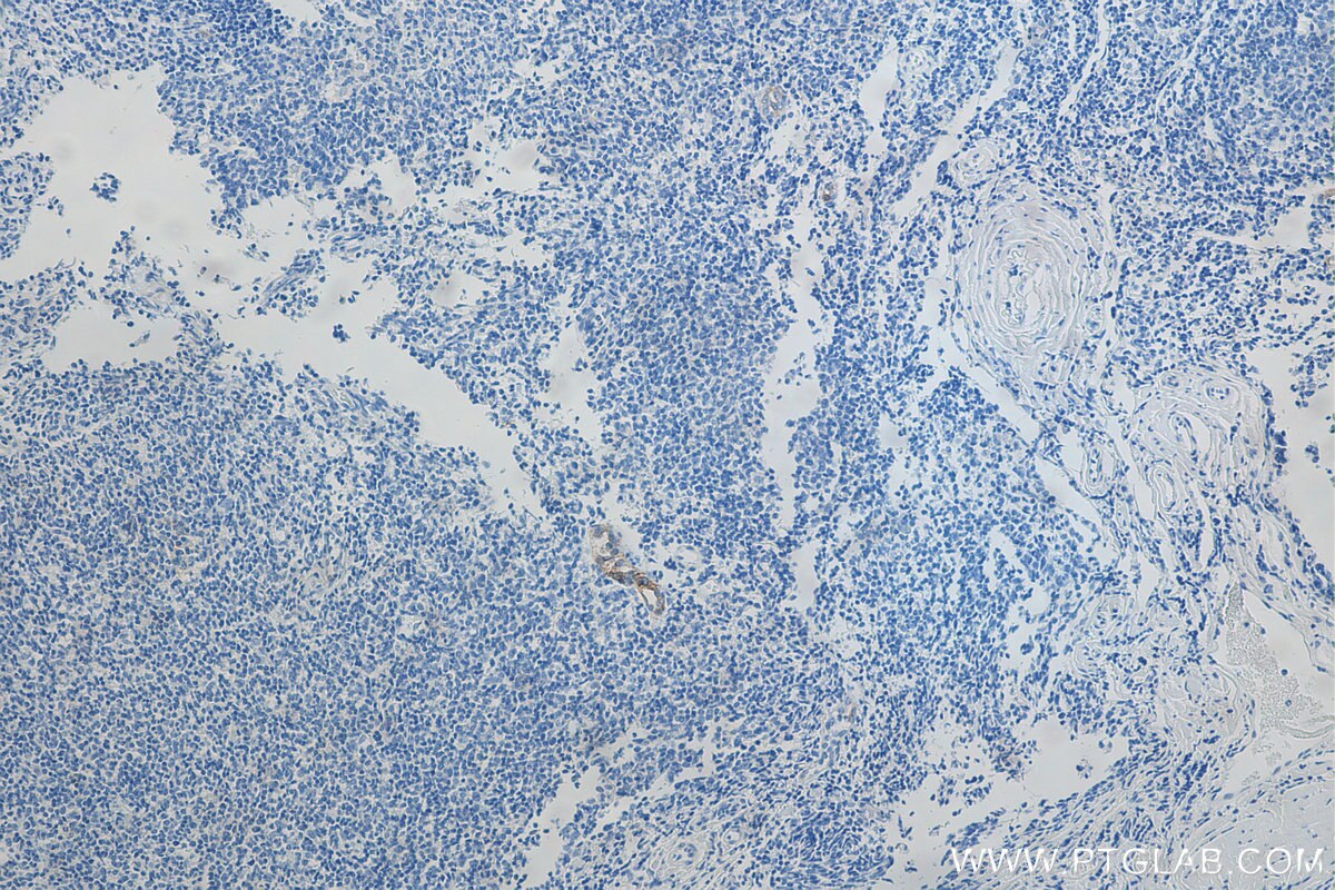 IHC staining of human tonsillitis using Biotin-66594