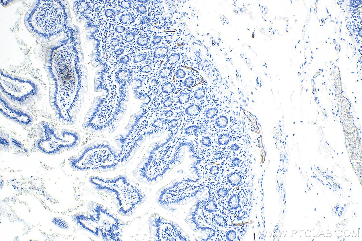Immunohistochemistry (IHC) staining of human small intestine tissue using Biotin-conjugated MAdCAM1 Monoclonal antibody (Biotin-66594)