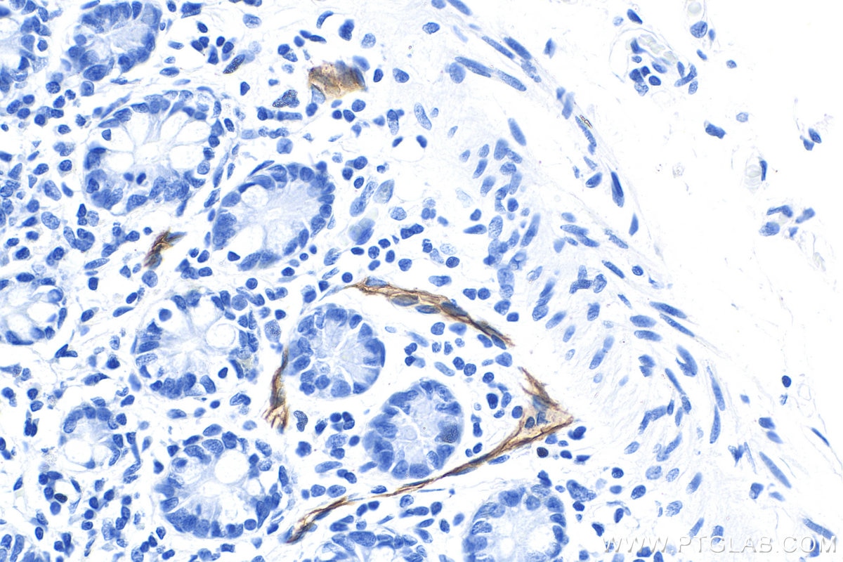 Immunohistochemistry (IHC) staining of human small intestine tissue using Biotin-conjugated MAdCAM1 Monoclonal antibody (Biotin-66594)