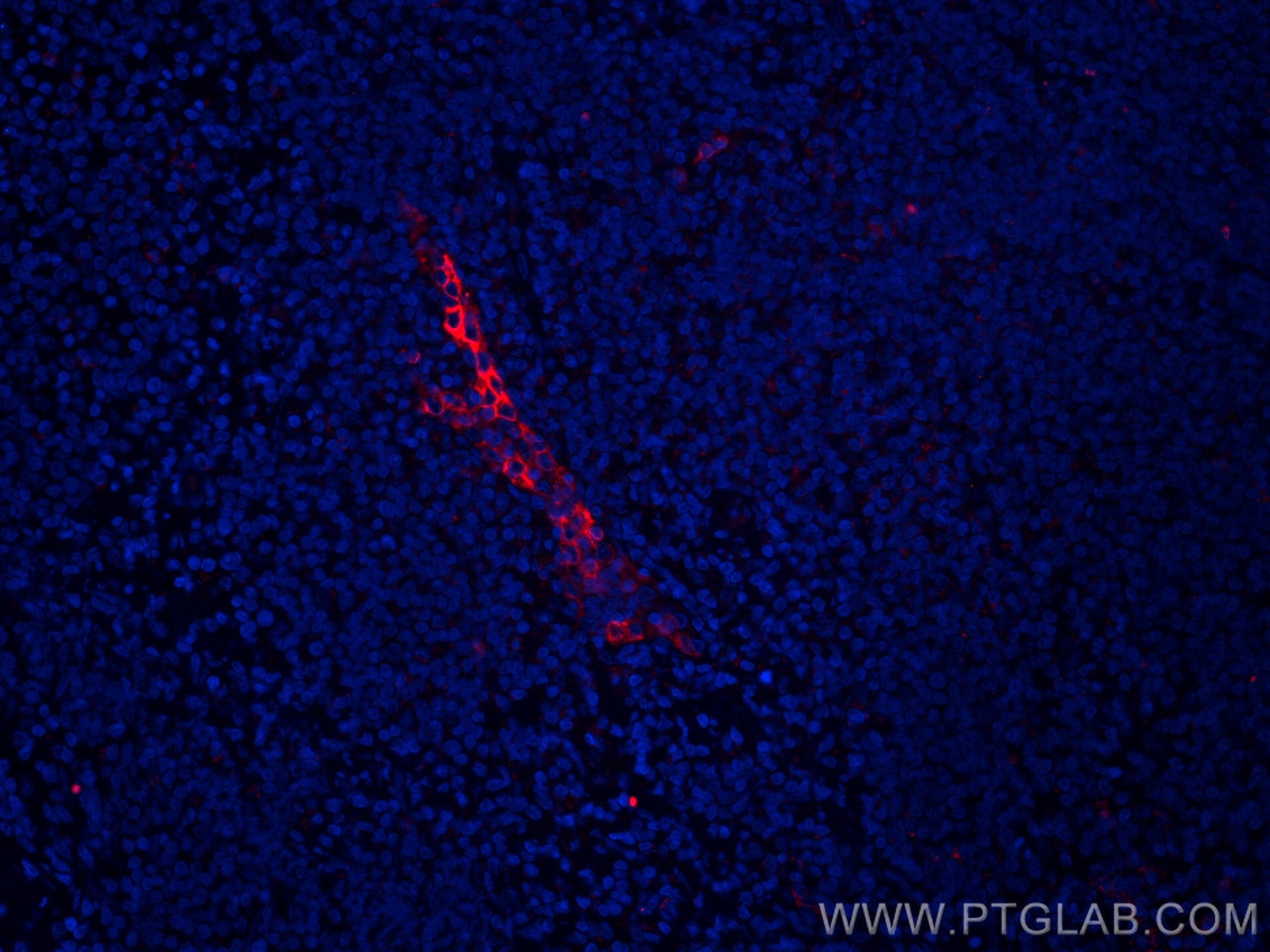 Immunofluorescence (IF) / fluorescent staining of human tonsillitis tissue using CoraLite®594-conjugated MAdCAM1 Monoclonal antibod (CL594-66594)