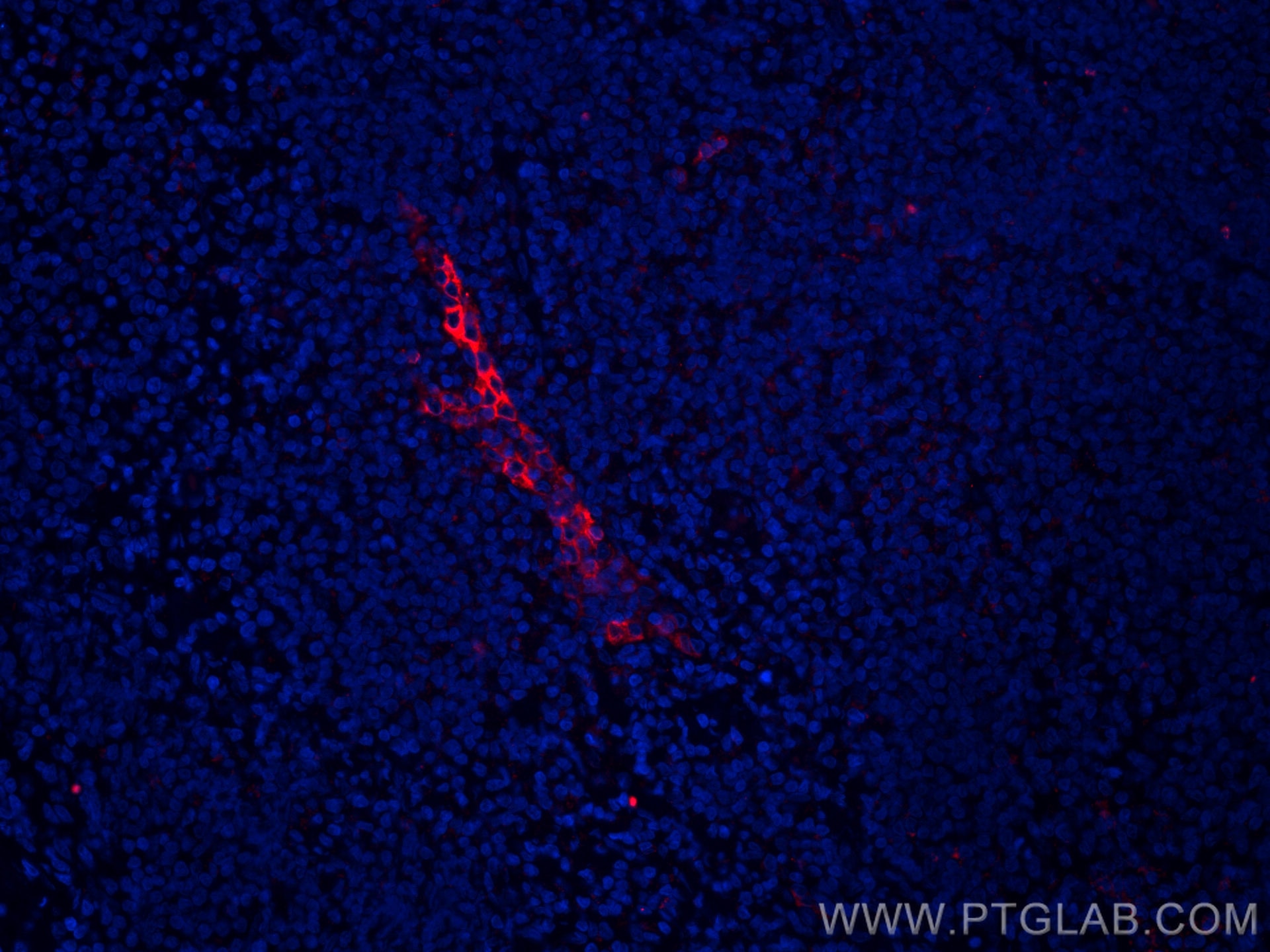 IF Staining of human tonsillitis using CL594-66594