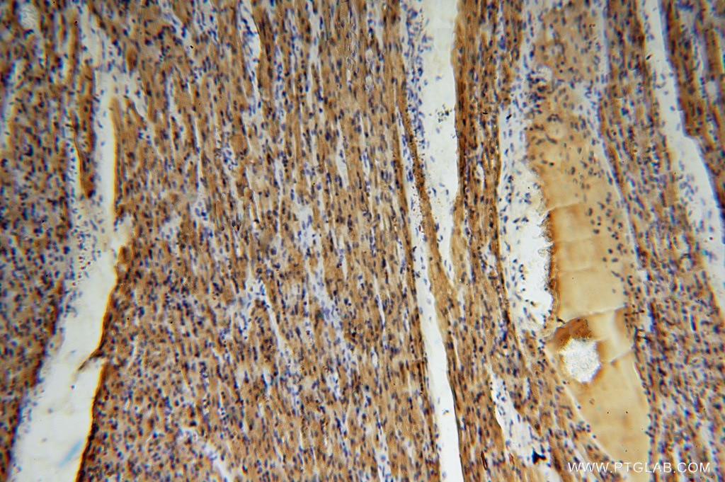 Immunohistochemistry (IHC) staining of human heart tissue using Myoglobin Polyclonal antibody (16048-1-AP)