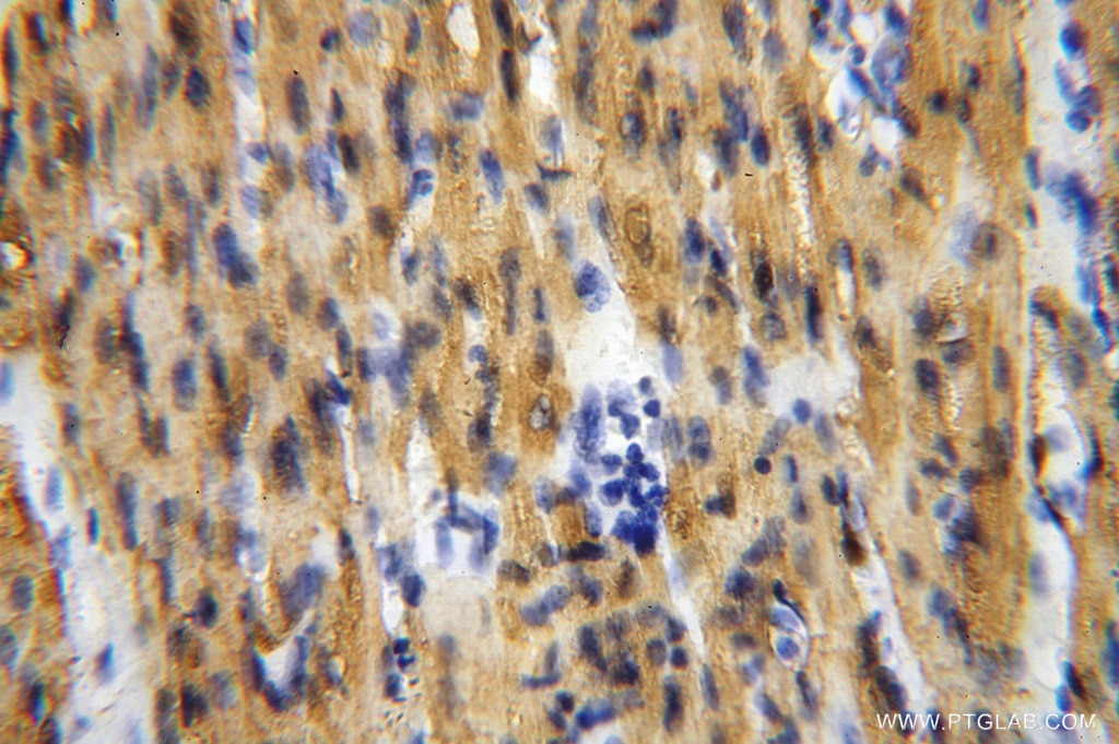 Immunohistochemistry (IHC) staining of human heart tissue using Myoglobin Polyclonal antibody (16048-1-AP)