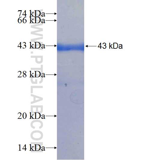 MB fusion protein Ag9000 SDS-PAGE
