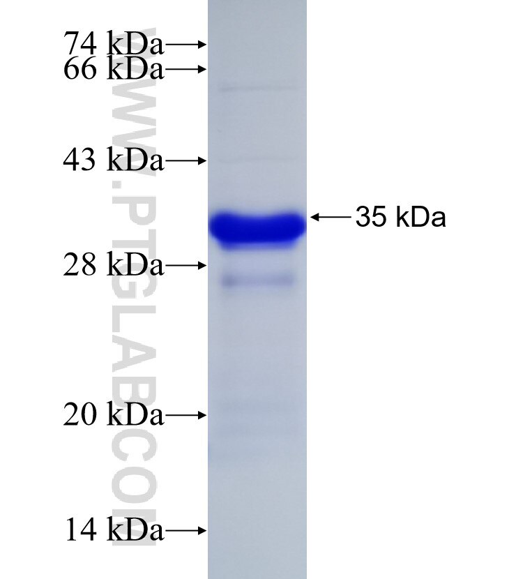 MBD1 fusion protein Ag32852 SDS-PAGE MBD1 fusion protein Ag32852 SDS-PAGE