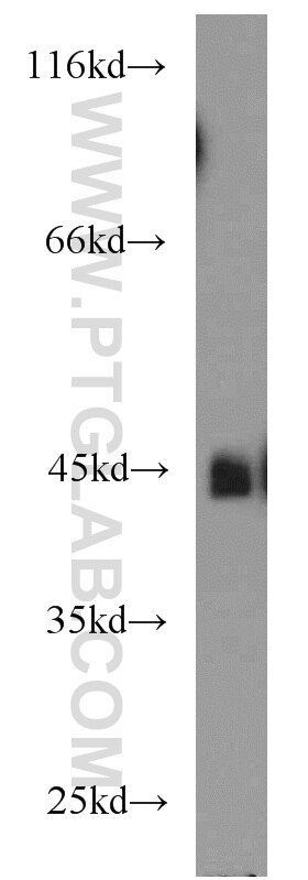 Western Blot (WB) analysis of human brain tissue using MBD2 Polyclonal antibody (55200-1-AP)