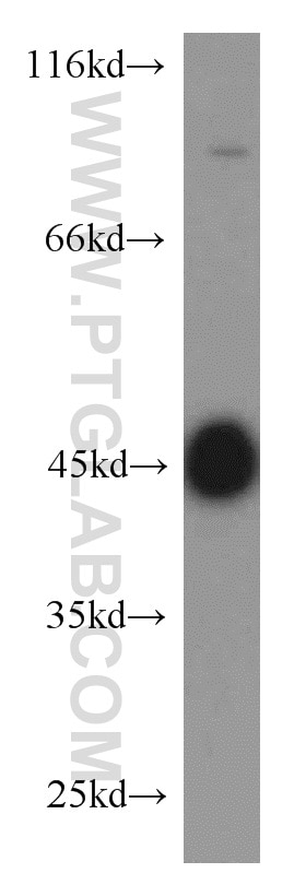 Western Blot (WB) analysis of human brain tissue using MBD2 Polyclonal antibody (55200-1-AP)