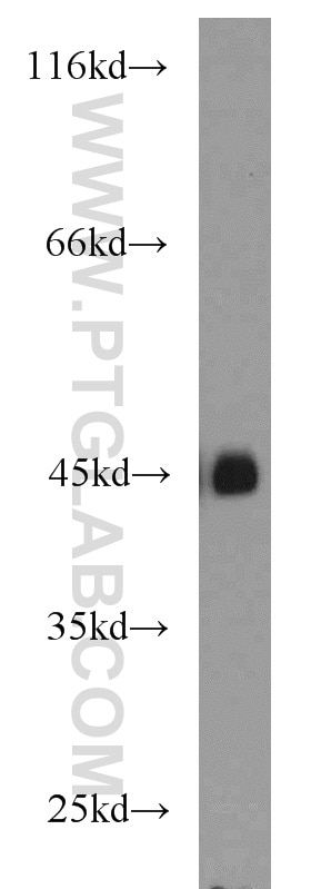 Western Blot (WB) analysis of human brain tissue using MBD2 Polyclonal antibody (55200-1-AP)