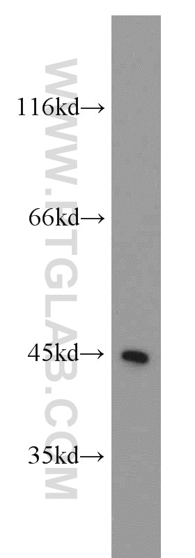 Western Blot (WB) analysis of Jurkat cells using MBD2 Polyclonal antibody (55200-1-AP)