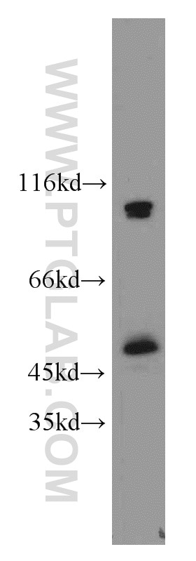 Western Blot (WB) analysis of RAW264.7 using MBD2 Polyclonal antibody (55200-1-AP)