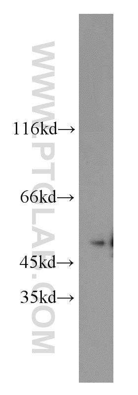 Western Blot (WB) analysis of A431 cells using MBD2 Polyclonal antibody (55200-1-AP)