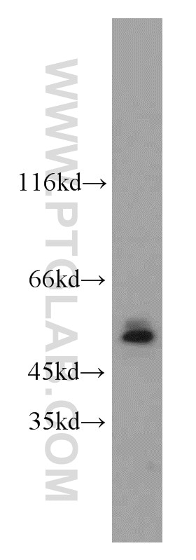 Western Blot (WB) analysis of A431 cells using MBD2 Polyclonal antibody (55200-1-AP)