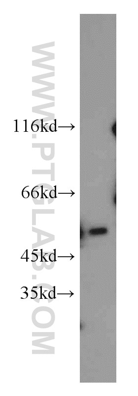 Western Blot (WB) analysis of A431 cells using MBD2 Polyclonal antibody (55200-1-AP)