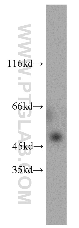 Western Blot (WB) analysis of HEK-293 cells using MBD2 Polyclonal antibody (55200-1-AP)