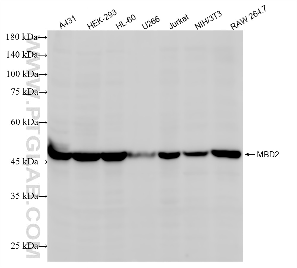 Western Blot (WB) analysis of various lysates using MBD2 Recombinant antibody (86393-3-RR)