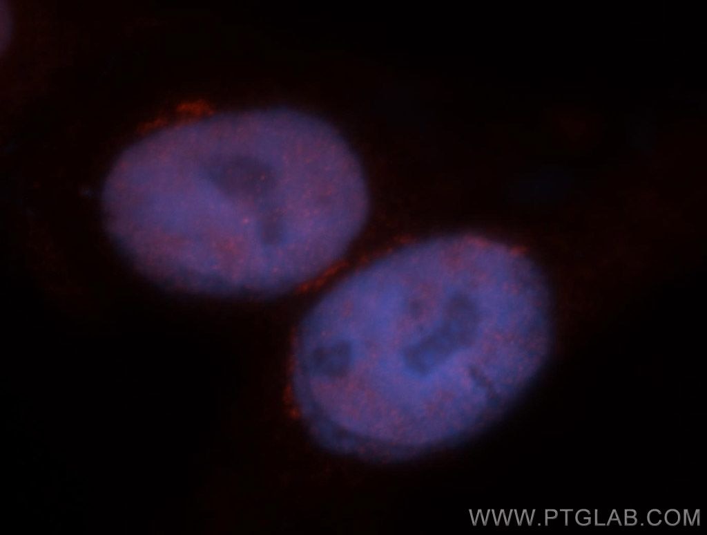 Immunofluorescence (IF) / fluorescent staining of HepG2 cells using MBD3 Polyclonal antibody (14258-1-AP)