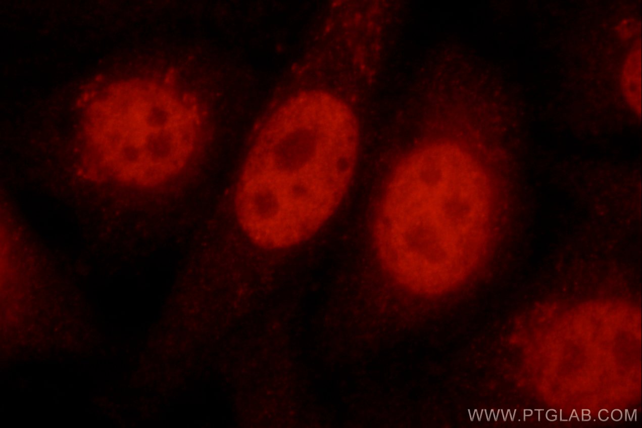 Immunofluorescence (IF) / fluorescent staining of HepG2 cells using MBD3 Polyclonal antibody (14258-1-AP)