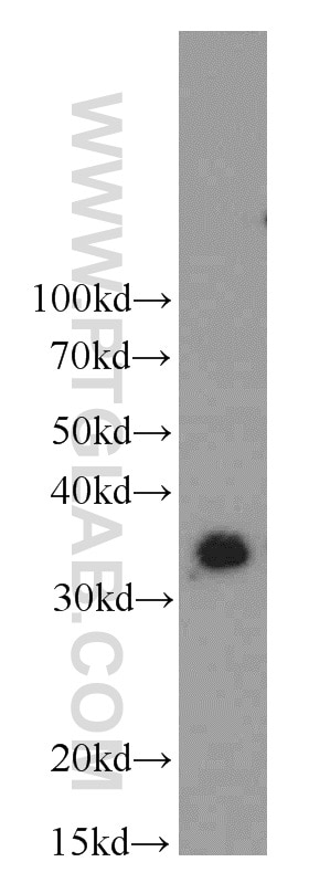 Western Blot (WB) analysis of Y79 cells using MBD3 Polyclonal antibody (14258-1-AP)