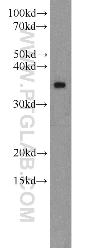 Western Blot (WB) analysis of MCF-7 cells using MBD3 Polyclonal antibody (14258-1-AP)