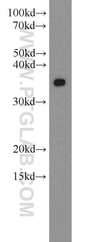 Western Blot (WB) analysis of COLO 320 cells using MBD3 Polyclonal antibody (14258-1-AP)