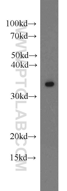 Western Blot (WB) analysis of Y79 cells using MBD3 Polyclonal antibody (14258-1-AP)