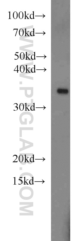 Western Blot (WB) analysis of Jurkat cells using MBD3 Polyclonal antibody (14258-1-AP)