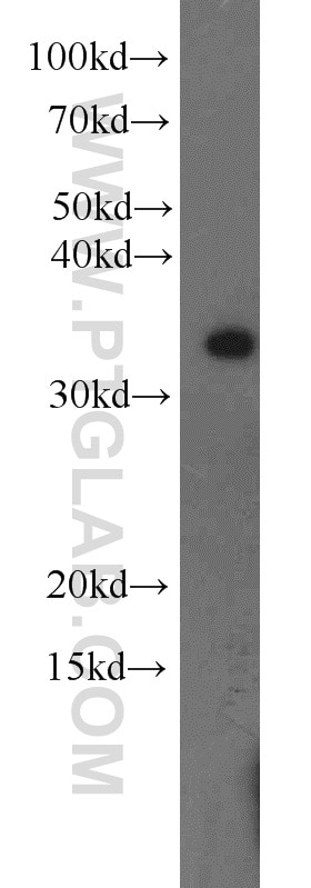 Western Blot (WB) analysis of HeLa cells using MBD3 Polyclonal antibody (14258-1-AP)