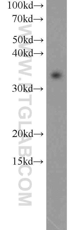 Western Blot (WB) analysis of HeLa cells using MBD3 Polyclonal antibody (14258-1-AP)