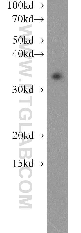 WB analysis of HeLa using 14258-1-AP