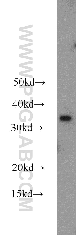 Western Blot (WB) analysis of MCF-7 cells using MBD3 Polyclonal antibody (14258-1-AP)