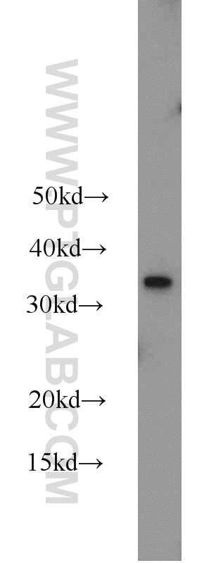 WB analysis of MCF-7 using 14258-1-AP