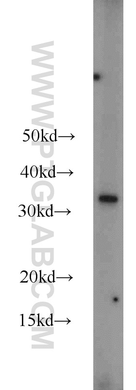 Western Blot (WB) analysis of MCF-7 cells using MBD3 Polyclonal antibody (14258-1-AP)