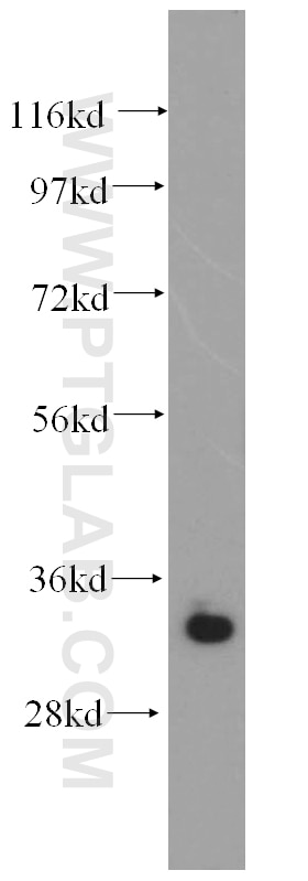 Western Blot (WB) analysis of Y79 cells using MBD3 Polyclonal antibody (14258-1-AP)