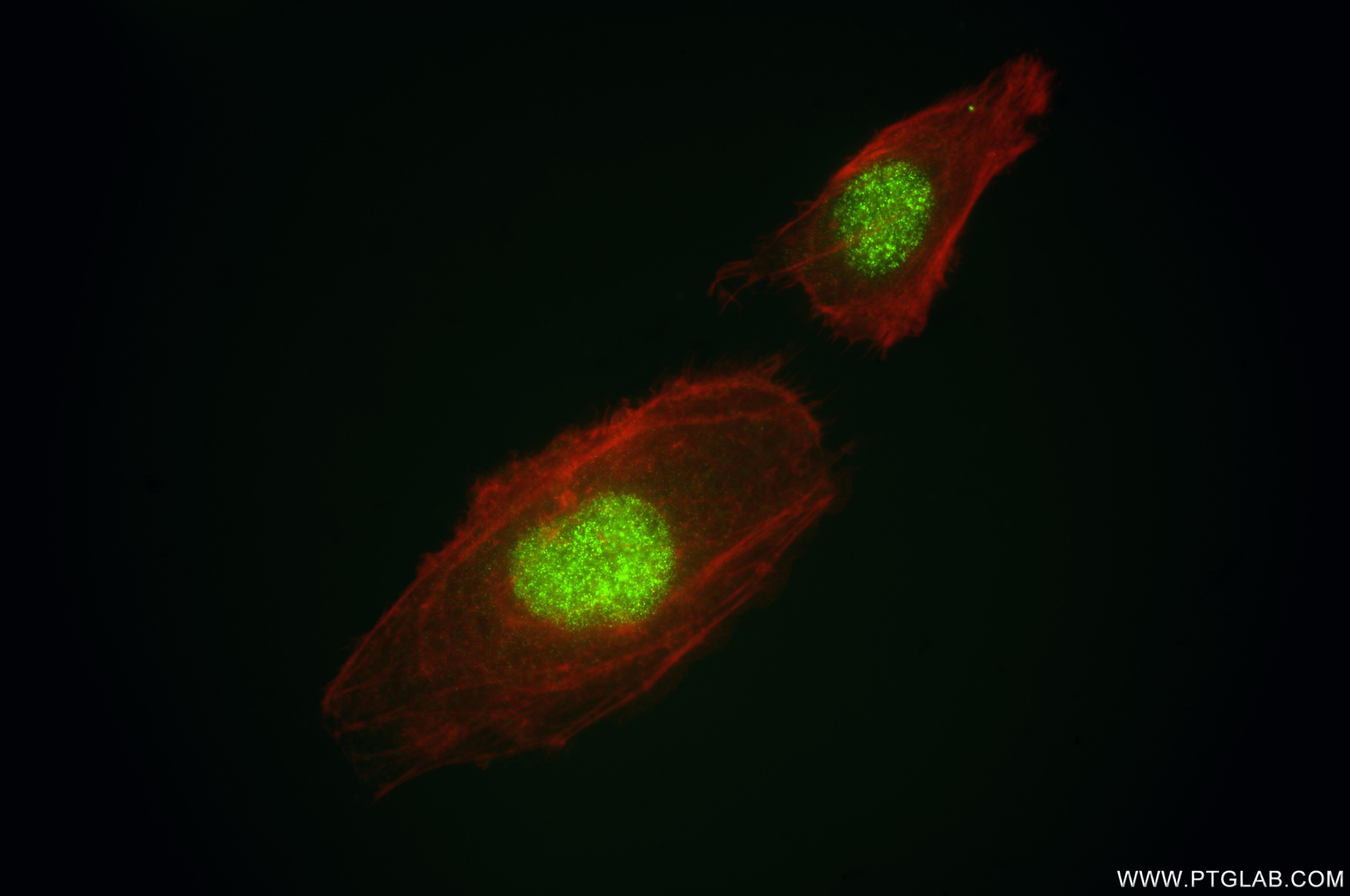 IF Staining of HeLa using 86681-2-RR (same clone as 86681-2-PBS) Immunofluorescence (IF) / fluorescent staining of HeLa cells using MBD3 Recombinant monoclonal antibody (86681-2-RR)