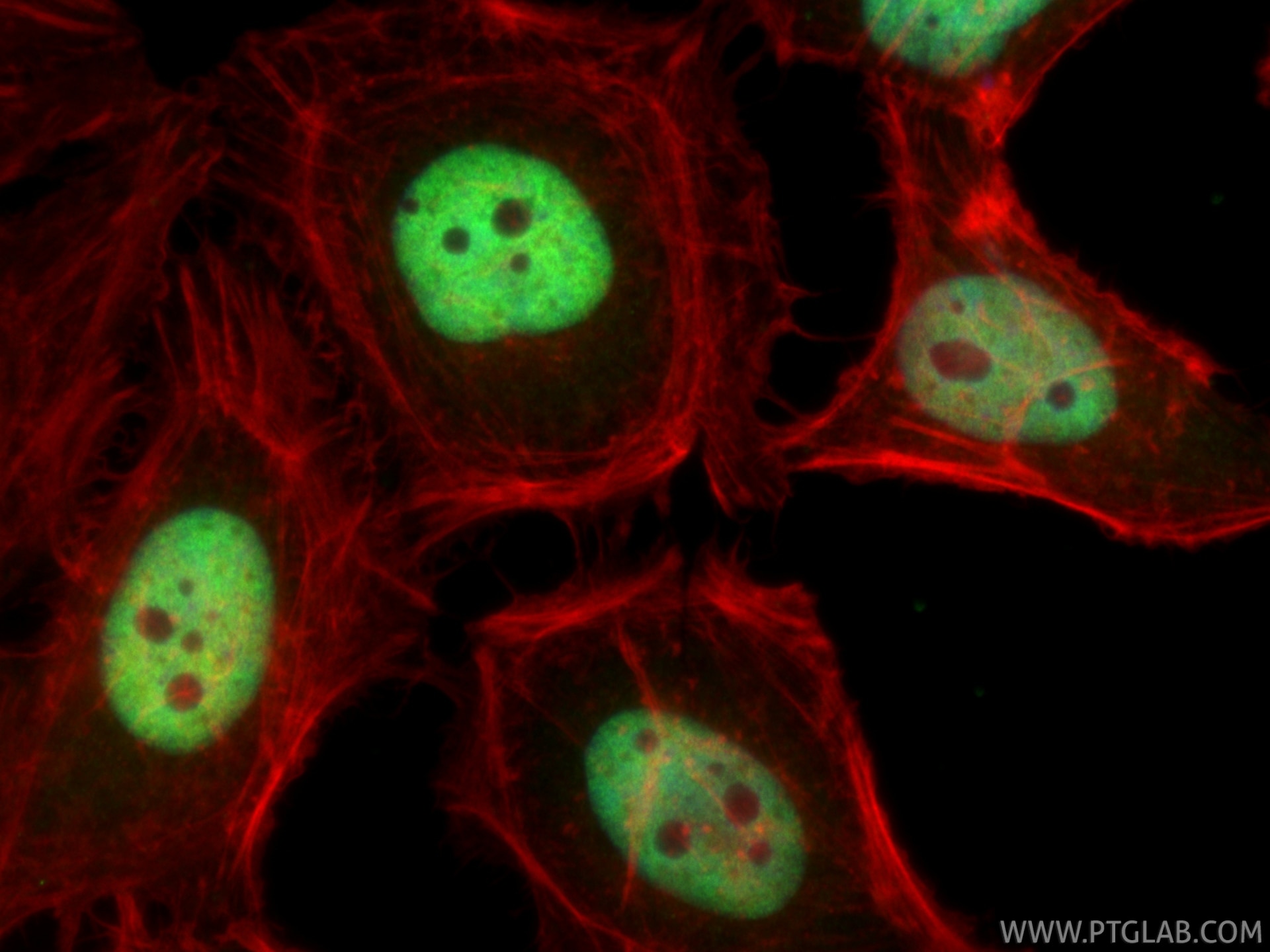 IF Staining of HeLa using 86681-2-RR (same clone as 86681-2-PBS) Immunofluorescence (IF) / fluorescent staining of HeLa cells using MBD3 Recombinant monoclonal antibody (86681-2-RR)