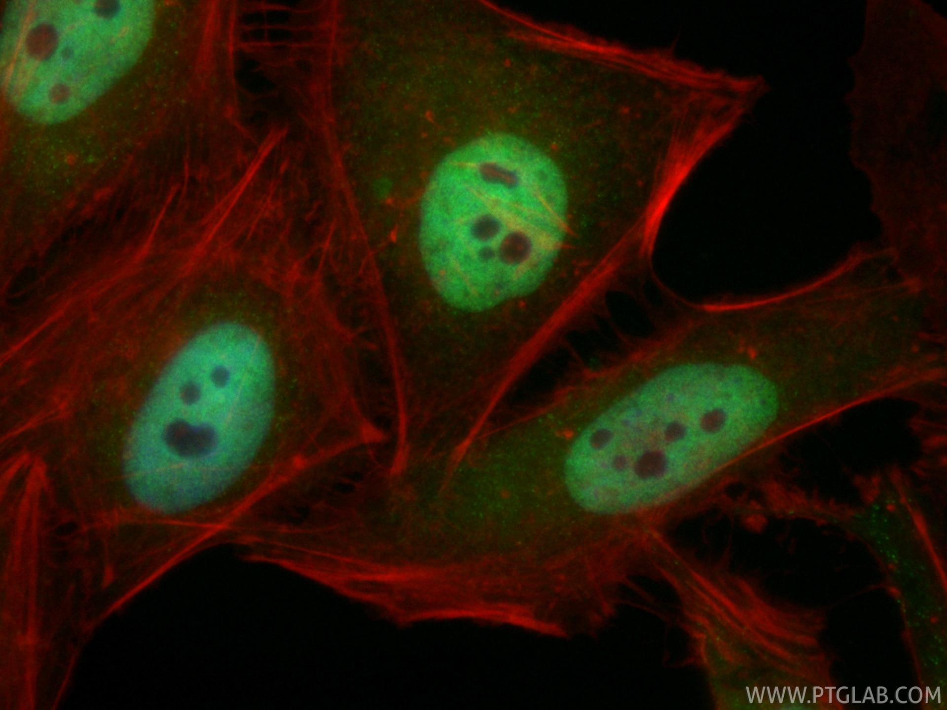 IF Staining of HeLa using CL488-86681-2 Immunofluorescence (IF) / fluorescent staining of HeLa cells using CoraLite® Plus 488-conjugated MBD3 Recombinant mon (CL488-86681-2)