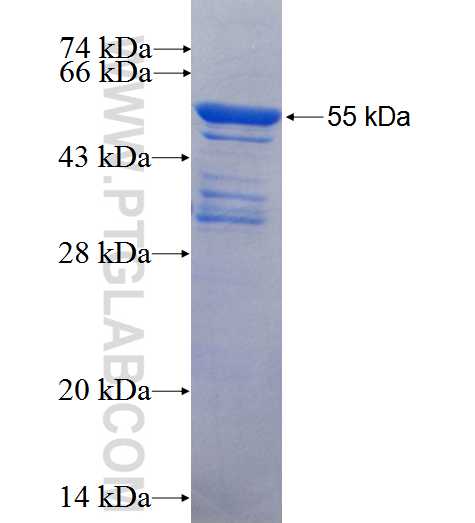 MBD3 fusion protein Ag5531 SDS-PAGE