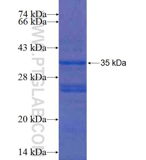 MBD3 fusion protein Ag5772 SDS-PAGE