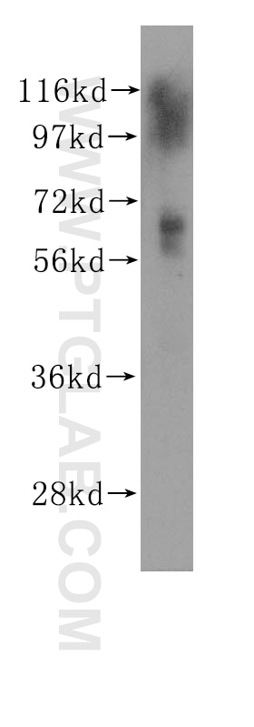 Western Blot (WB) analysis of A549 cells using MBD4 Polyclonal antibody (11270-1-AP)
