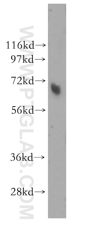 Western Blot (WB) analysis of human skin tissue using MBD4 Polyclonal antibody (11270-1-AP)