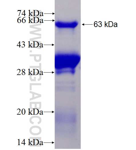 MBD4 fusion protein Ag1822 SDS-PAGE
