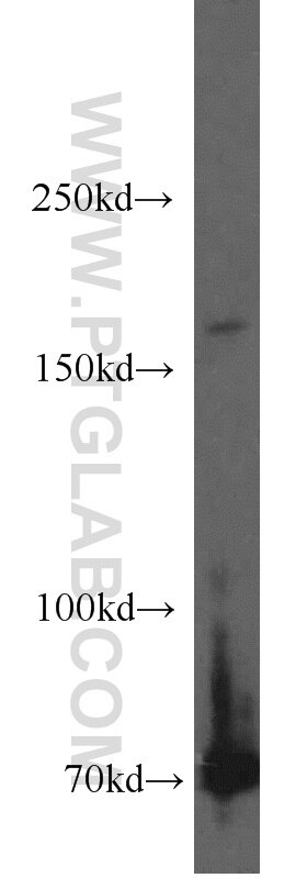 Western Blot (WB) analysis of mouse skeletal muscle tissue using MBD5 Polyclonal antibody (15961-1-AP)